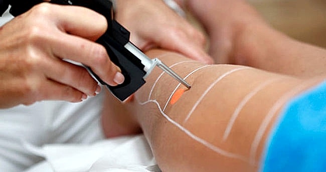 Bulundurulması yasak olan epilasyon cihazı bulunduğu ve uygulama yapıldığından bahisle işyeri ruhsatının iptali