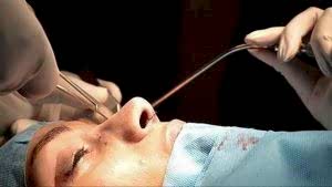 ÖZEL HASTANE VE/VEYA HEKİME KARŞI AÇILACAK ESTETİK OPERASYONLARDAN KAYNAKLANAN TAZMİNAT DAVALARINDA DAVA AÇMA SÜRESİ VE GÖREVLİ MAHKEME